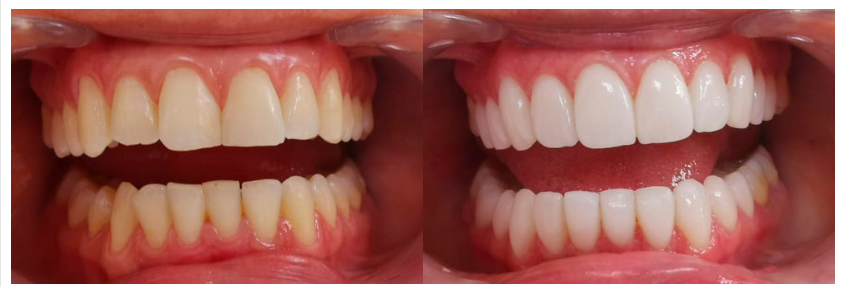 Dental surgery Guadalajara